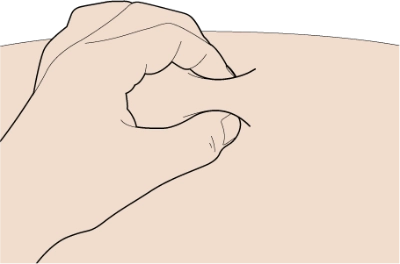 pinch skin
